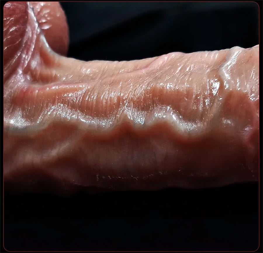 8.5in Realistic Penis for Women Foreskin Move Big Dick Huge Suction Cup Dildo Female Masturbator Adult Sex Toys Anal Stimulation